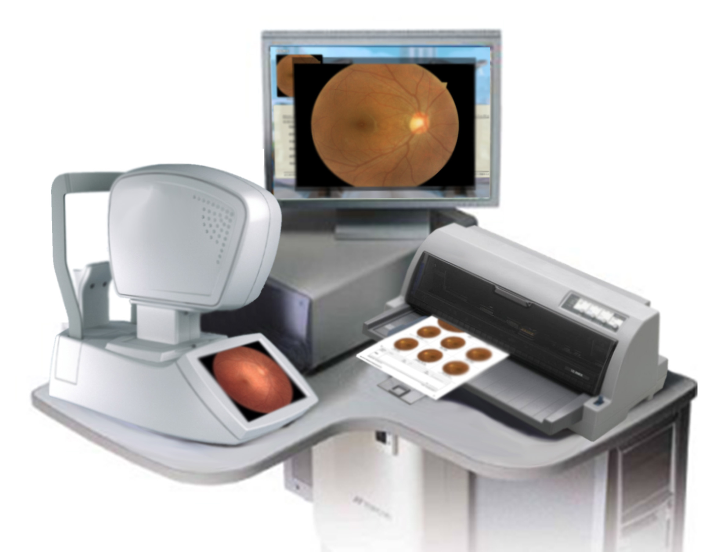 眼底圖像篩查產(chǎn)品頁——產(chǎn)品形態(tài)